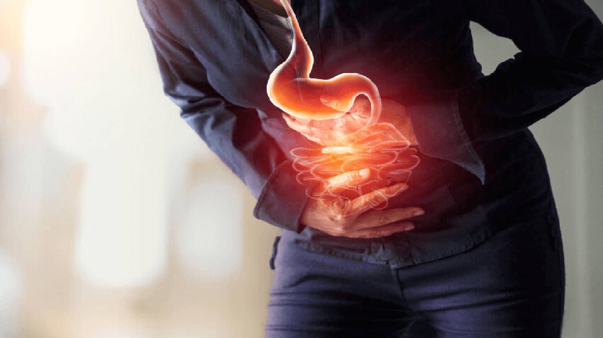 Digestive Issues